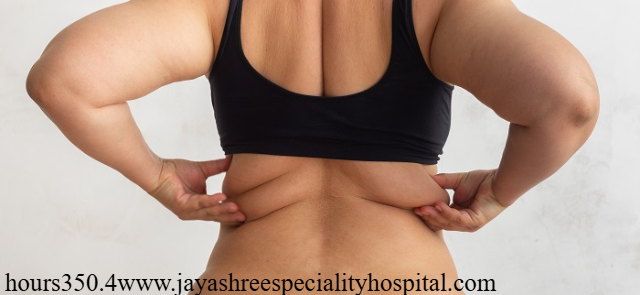 Cara Ampuh Menghilangkan Lemak di Punggung